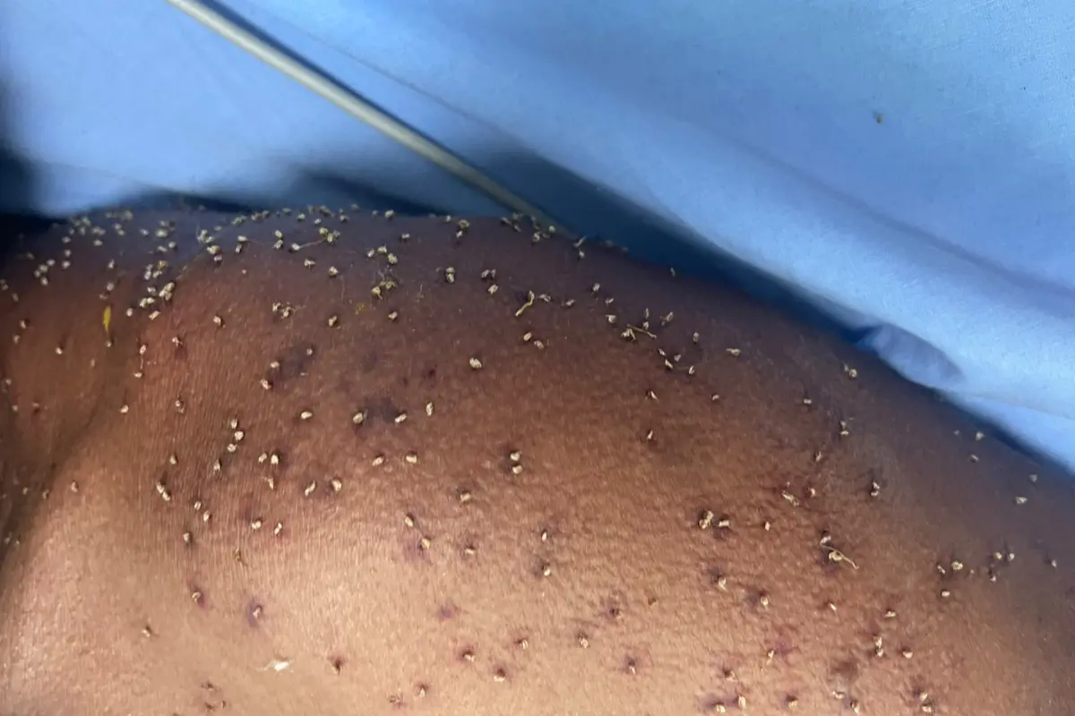 Homem é resgatado inconsciente após ataque de abelhas